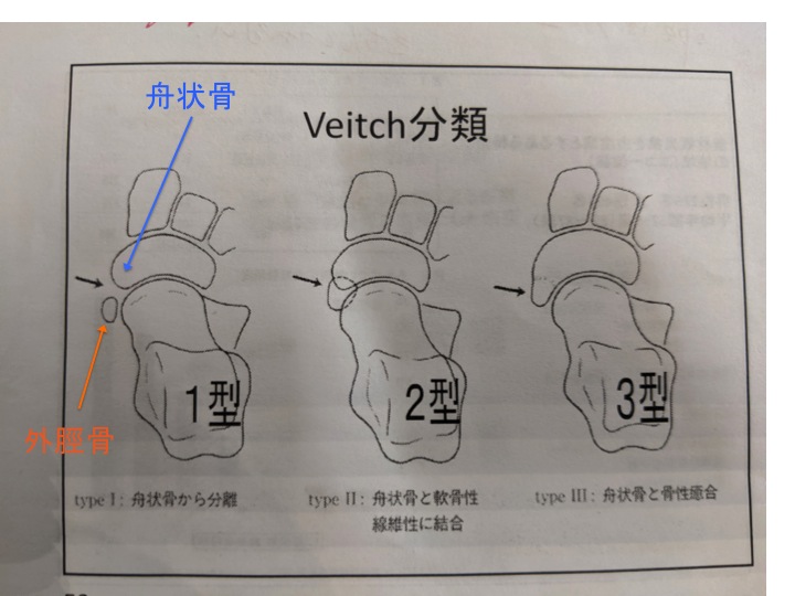 veitch分類